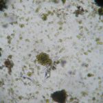 ALGEE MICROSCOPE SCREENSHOT