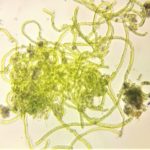 ALGEE MICROSCOPE SCREENSHOT