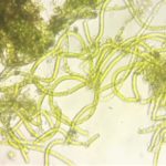 ALGEE MICROSCOPE SCREENSHOT